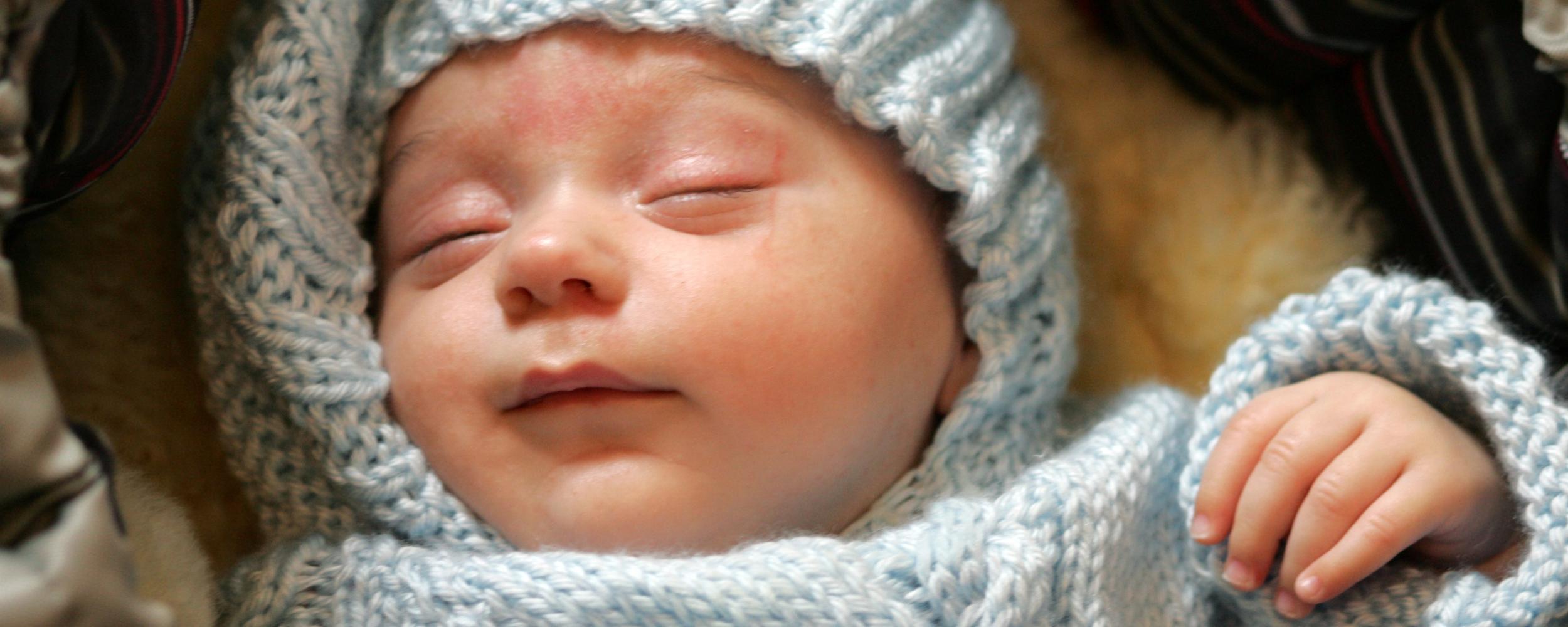 Babykopf