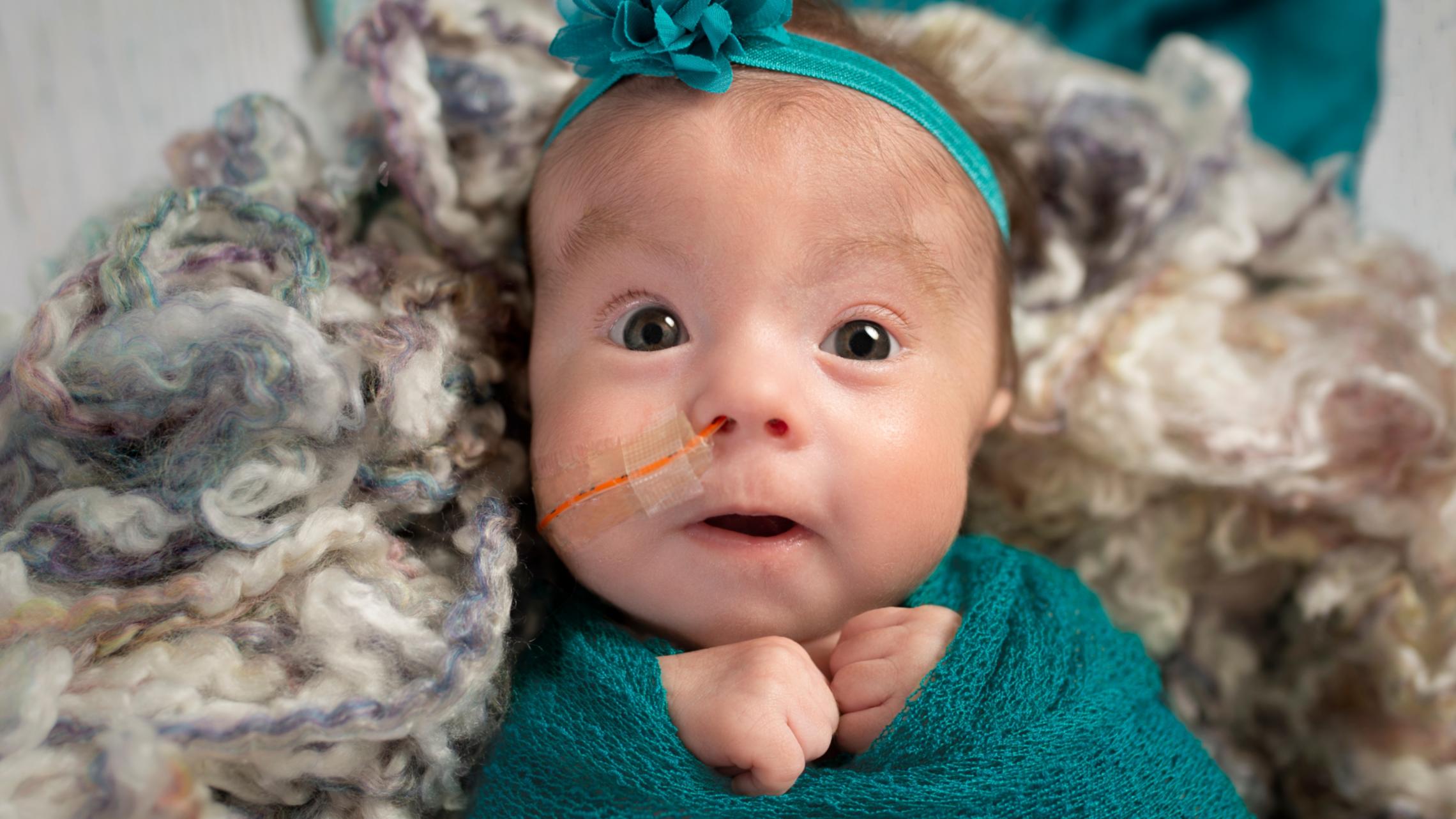 Baby mit Schlauch mit Luft zum Atmen in der Nase