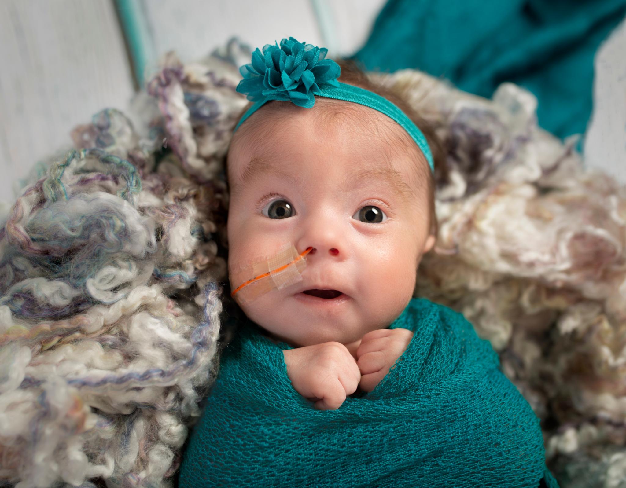 Baby mit Schlauch mit Luft zum Atmen in der Nase